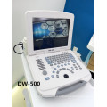 máquina de ultra-som recondicionado portátil para monitor de paciente
